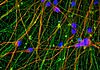 Human iPS-derived neurons; Immunofluorescence