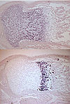 In situ Hybridisierung von neugeborenen Maustibiae mit Sonden für Collagen II (oben) und X (unten)