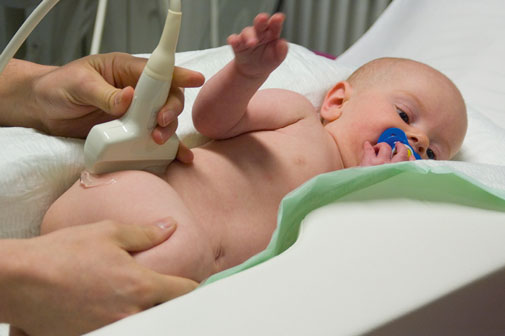 Ultraschalluntersuchung eines Säuglings