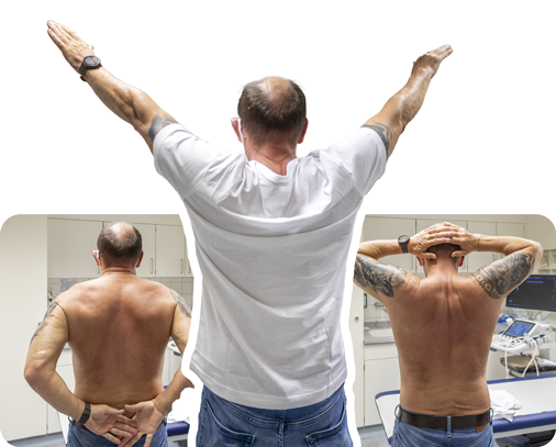 Schulterbeweglichkeit mit Gelenkersatz