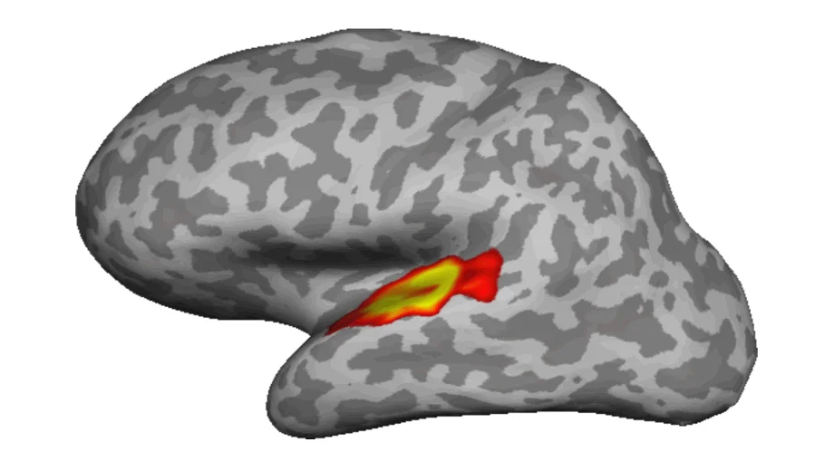 Cortical reconstruction of a human brain with functional activation