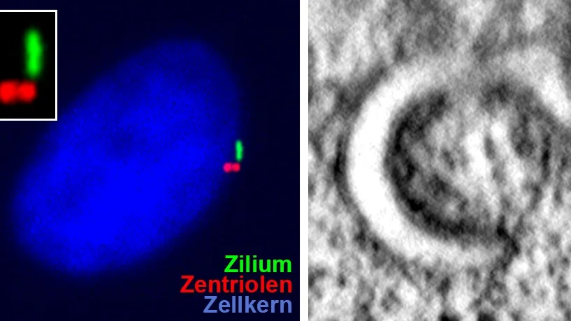 Lichtmikroskopische und Fluoreszenzmikroskopische Aufnahmen