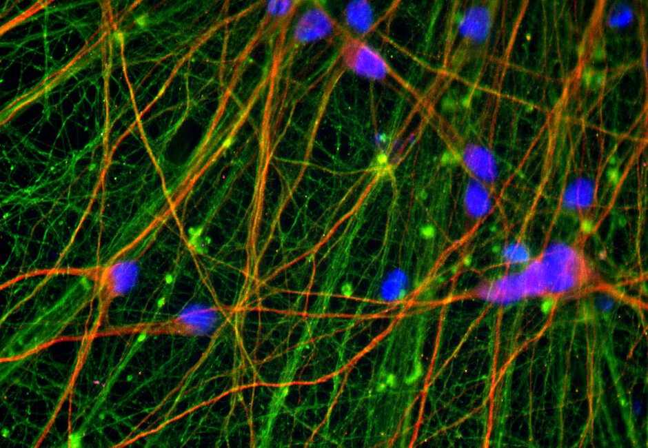 Mikroskopische Aufnahme von Nervenzellen mit grün dargestellten neuronalen Netzwerken und blauen Zellkernen.