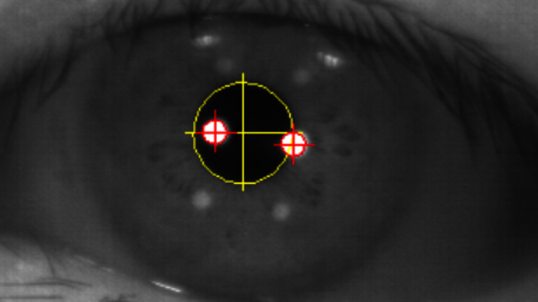 Auge bei der Augenbewegungsmessung